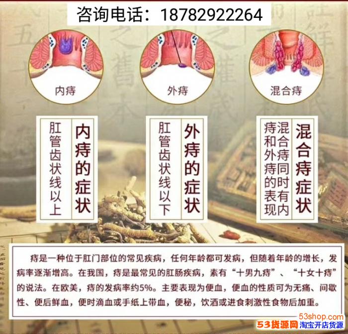 朋友圈的婉慈志德舒痔疮膏效果怎么样?多少钱一盒?