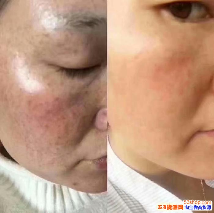 卖保险需要什么证_卖保健食品需要什么证_卖化妆品需要健康证吗