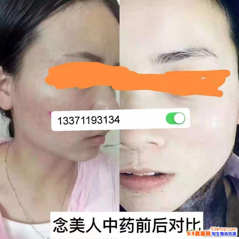 念美人护肤品价格念美佳人中药面膜怎么样