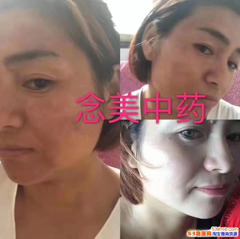 念美人护肤品价格念美佳人中药面膜怎么样