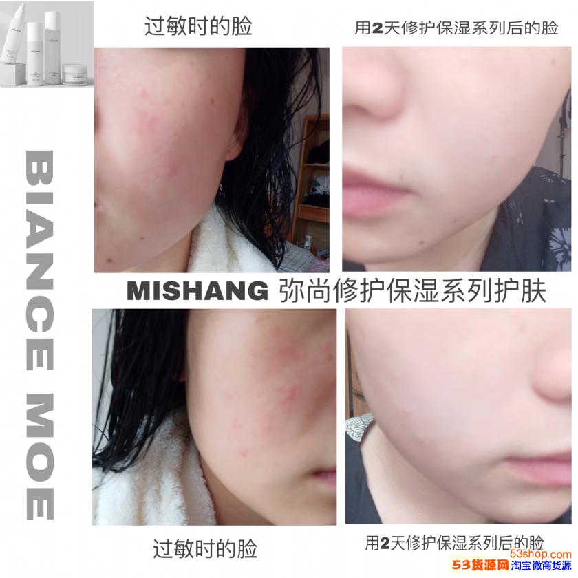 皮肤油可以用吗?