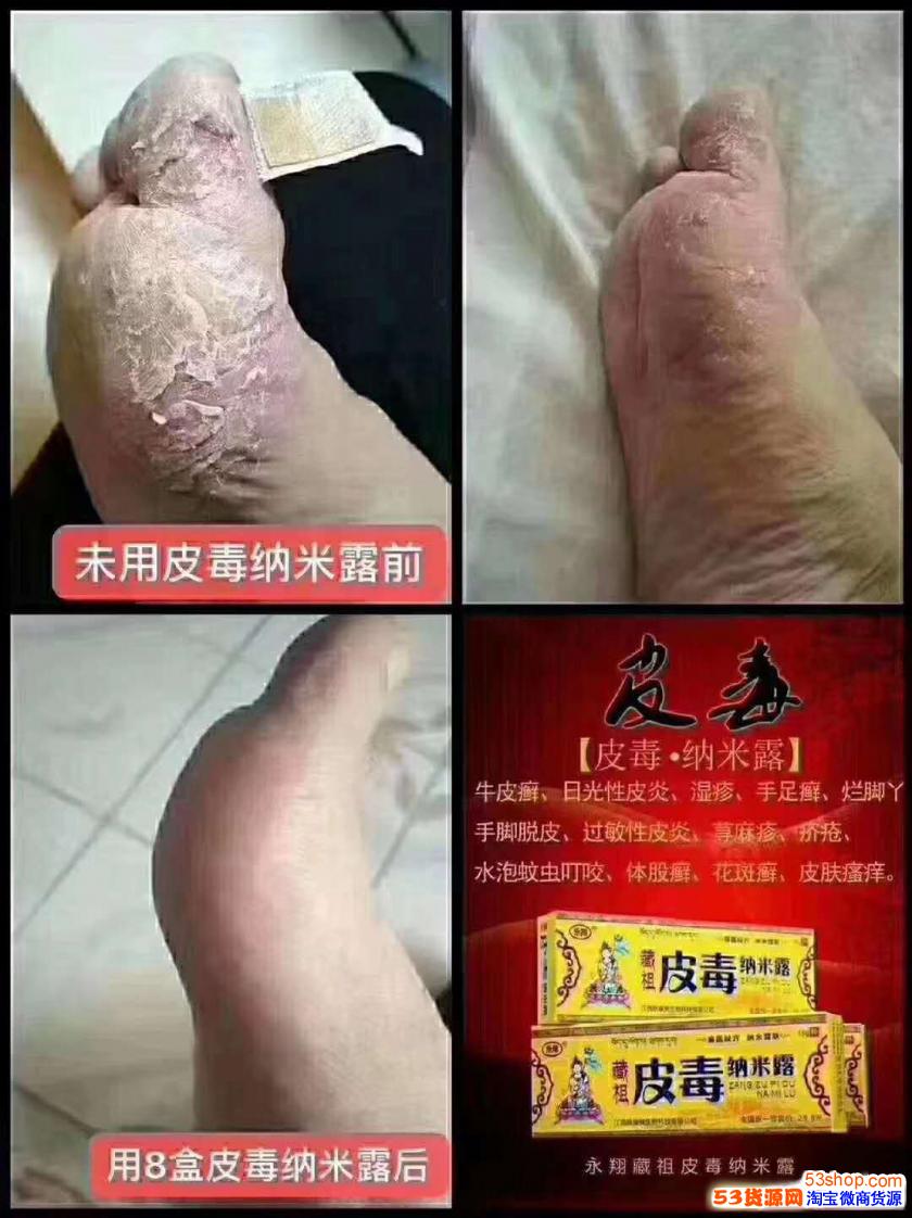 臧祖骨霸纳米露功效怎么样多少钱一盒