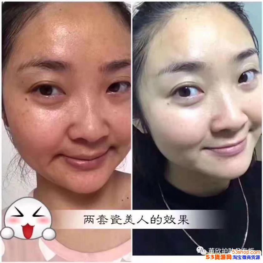 董欣瓷美人套盒功效及美白淡斑原理