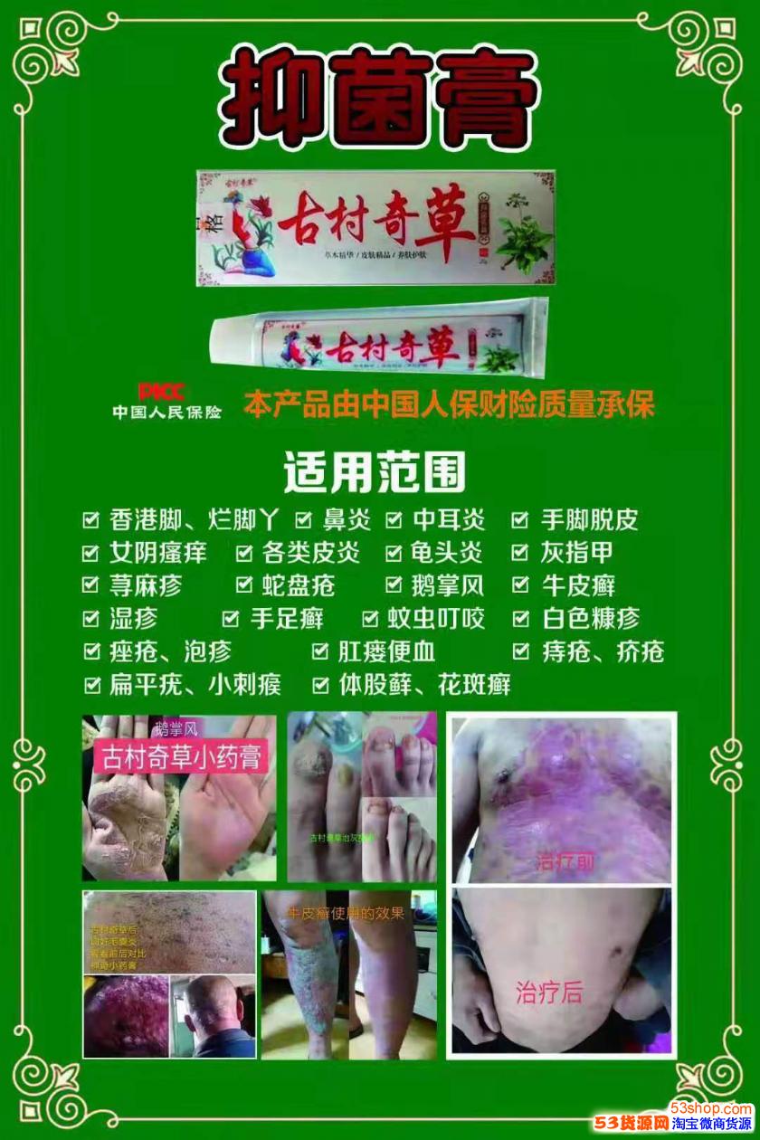 古村奇草抑菌膏治溼疹嗎按療程使用可以治癒嗎