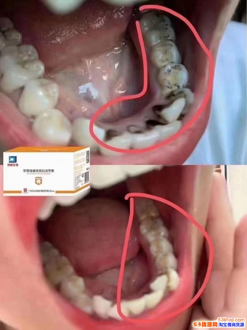 抖音上的牙粉真的有用吗叫什么牌子牙管佳牙粉