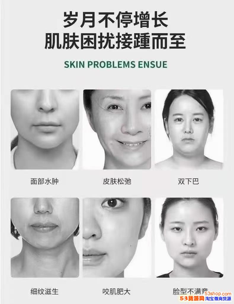 面部皮肤下垂怎么办 如何改善法令纹和嘴角纹 53货源网