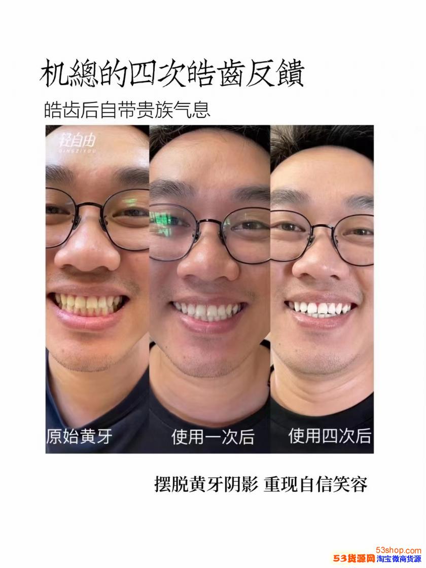 碧缇福美牙仪有副作用轻自由美牙仪能买吗