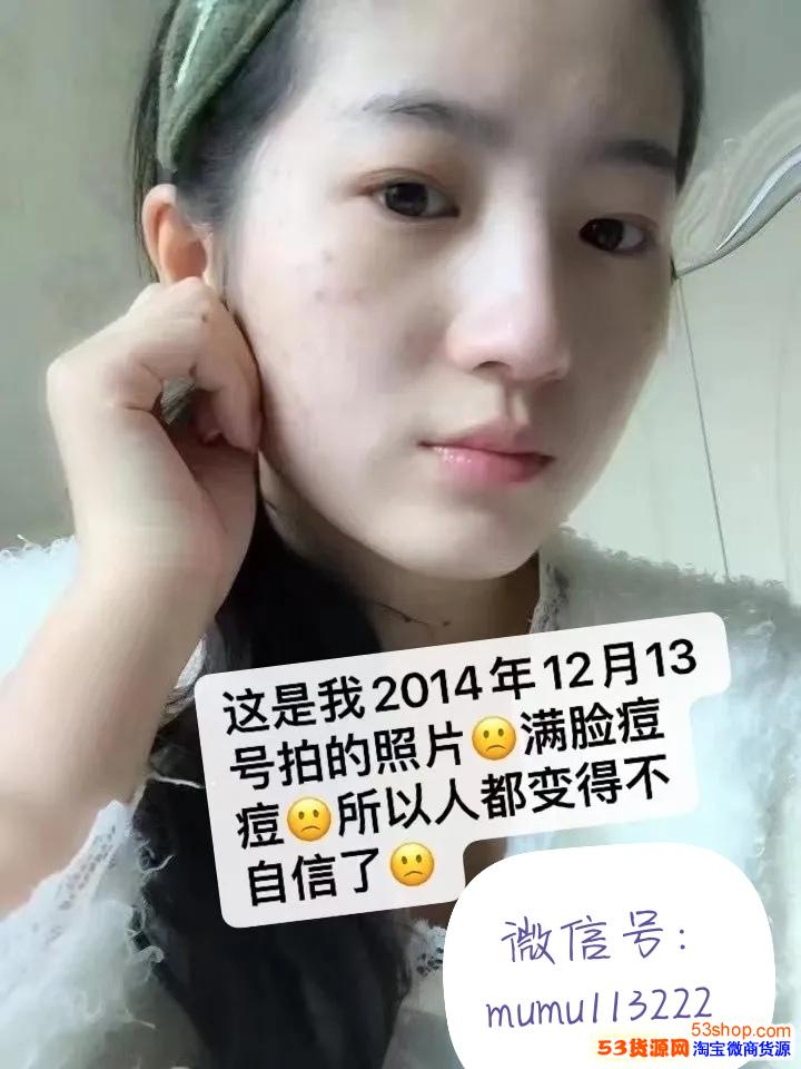 神首集团木木公主家护肤品产品介绍效果真有这么好吗